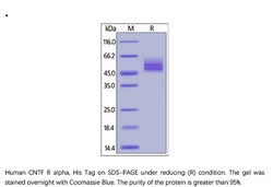 ACROBiosystems Recombinant Protein;Human CNTF R alpha Protein;HEK293;100UG;CNR,CNTFR,CNTF