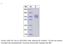 ACROBiosystems Recombinant Protein;Human uPAR / PLAUR Protein;HEK293;200UG;UPR,uPAR,PLAUR,CD87,MO3,U-PAR,