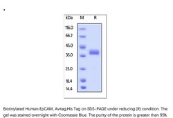 ACROBiosystems Recombinant Protein;Biotinylated Human EpCAM / TROP1 Protein,