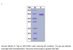 ACROBiosystems Recombinant Protein;Human NKp46 / NCR1 / CD335 Protein,