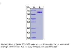 ACROBiosystems Recombinant Protein;Human TYRO3 / Dtk Protein, Fc Tag;HEK293;200UG;TY3,TYRO3,BYK,DTK,RSE,SKY,TIF,TYRO-3,