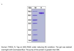 ACROBiosystems Recombinant Protein;Human TYRO3 / Dtk Protein, Fc Tag;HEK293;1MG;TY3,TYRO3,BYK,DTK,RSE,SKY,TIF,TYRO-3,