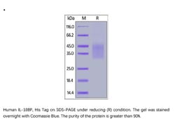 ACROBiosystems Recombinant Protein;Human IL-18BP Protein;HEK293;200UG;ILP,IL18BP,IL18BPa,Tadekinig-alfa,IL-18BP,IL-18BPa,IL-18