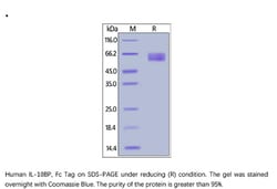 ACROBiosystems Recombinant Protein;Human IL-18BP Protein, Fc Tag;HEK293;1MG;ILP,IL18BP,IL18BPa,Tadekinig-alfa,IL-18BP,IL-18BPa,IL-18