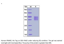 ACROBiosystems Recombinant Protein;Human IFN-alpha / beta R2 Protein;HEK293;1MG;IF2,IFNAR2,IFNARB,IFNABR,IFN-R-2,IFN-alpha/beta