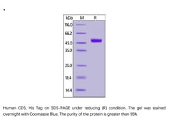 ACROBiosystems Recombinant Protein;Human CD5 Protein;HEK293;1MG;CD5,CD5,LEU1,LEU-1,