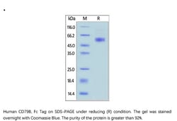 ACROBiosystems Recombinant Protein;Human CD79B Protein, Fc Tag;HEK293;100UG;CDB,CD79b,B29,IGB,Ig-beta,