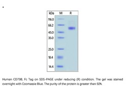 ACROBiosystems Recombinant Protein;Human CD79B Protein, Fc Tag;HEK293;1MG;CDB,CD79b,B29,IGB,Ig-beta,