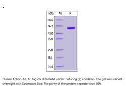 ACROBiosystems Recombinant Protein;Human Ephrin-A3 / EFNA3 Protein, Fc