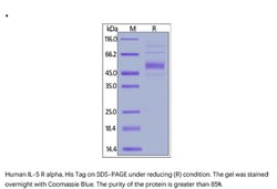 ACROBiosystems Recombinant Protein;Human IL-5 R alpha / CD125 Protein;HEK293;50UG;ILA,IL5RA,CD125,IL-5RA,IL-5R-alpha,CDw125,IL5R,