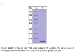 ACROBiosystems Recombinant Protein;Human S100B Protein;E.coli;100UG;S1B,S100B,S100-B,NEF,S100,S100beta,