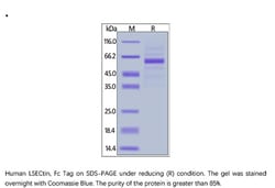 ACROBiosystems Recombinant Protein;Human LSECtin / CLEC4G Protein, Fc Tag;HEK293;1MG;CLG,CLEC4G,LSECtin,