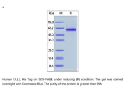 ACROBiosystems Recombinant Protein;Human DLL1 / Delta1 Protein;HEK293;100UG;DL1,DLL1,Delta1,H-Delta-1,