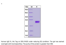 ACROBiosystems Recombinant Protein;Human IgG1 Fc Protein, His Tag;HEK293;1MG;IG1,IgG1
