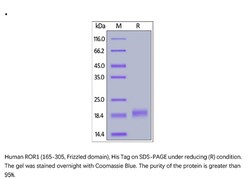ACROBiosystems Recombinant Protein;Human ROR1 (165-305, Frizzled domain)