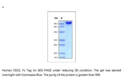 ACROBiosystems Recombinant Protein;Human CD31 / PECAM-1 Protein, Fc Tag;HEK293;1MG;CD1,PECAM1,PECAM-1,CD31,CD-31,FLJ34100,FLJ58394,PECAM,
