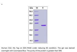 ACROBiosystems Recombinant Protein;Human Carbonic Anhydrase II / CA2 Protein;HEK293;100UG;CA2,CA2,CA-II,CAII,Car2,CA-2,Carbonic
