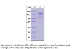ACROBiosystems Recombinant Protein;Human Cadherin-6 / KCAD / CDH6 Protein;HEK293;100UG;CA6,CDH6,CAD6,KCAD,K-cadherin,Cadherin-6,CDH-6,