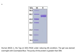 ACROBiosystems Recombinant Protein;Human BACE-1 Protein;HEK293;1MG;BA1,BACE1,BACE-1,ASP2,BACE,FLJ90568,HSPC104,KIAA1149,memapsin-2,memapsin