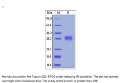 ACROBiosystems Recombinant Protein;Human Azurocidin / CAP37 / AZU1 Protein;HEK293;100UG;AZ1,AZU1,Azurocidin,HBP,AZAMP,AZU,CAP37,HUMAZUR,NAZC,