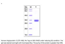 ACROBiosystems Recombinant Protein;Human Angiopoietin-2 / ANGPT2 (275-496)