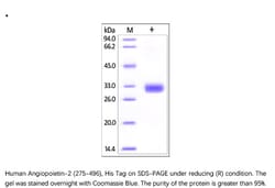 ACROBiosystems Recombinant Protein;Human Angiopoietin-2 / ANGPT2 (275-496)