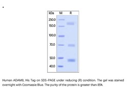ACROBiosystems Recombinant Protein;Human ADAM8 / CD156a Protein;HEK293;50UG;AD8,ADAM8,MS2,CD156a,CD156,ADAM-8,MS-2,ADAM,