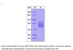 ACROBiosystems Recombinant Protein;Human Activin RIIB / ACVR2B Protein;HEK293;200UG;ACB,ACVR2B,ACTRIIB,ACVR-2B,ACTR-IIB,ActR-IIB,ACTRⅡB,ACTR-ⅡB,MGC116908,ACVRIIB,Activin