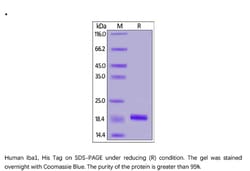 ACROBiosystems ACROBiosystems Human Iba1 / AIF-1 Protein, His Tag, Quantity: