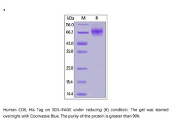 ACROBiosystems ACROBiosystems Human CD6 / TP120 Protein, His Tag, Quantity: