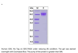 ACROBiosystems ACROBiosystems Human CD6 / TP120 Protein, His Tag, Quantity: