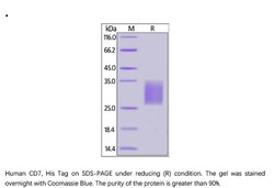 ACROBiosystems Human CD7 Protein, His Tag