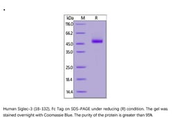 ACROBiosystems ACROBiosystems Human Siglec-3 / CD33 (18-132) Protein, Fc