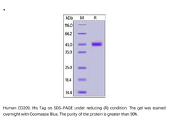 ACROBiosystems ACROBiosystems Human CD209 / DC-SIGN Protein, His Tag, Quantity: