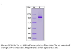 ACROBiosystems ACROBiosystems Human CD206 / MMR Protein, His Tag, Quantity: