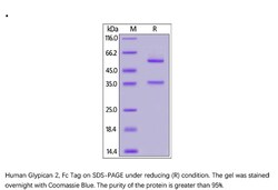 ACROBiosystems ACROBiosystems Human Glypican 2 / GPC2 Protein, Fc Tag,