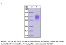 ACROBiosystems ACROBiosystems Human CLEC12A / MICL / CLL-1 Protein, His