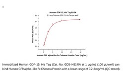 ACROBiosystems ACROBiosystems Human GDF-15 / MIC-1 Protein, His Tag, Quantity: