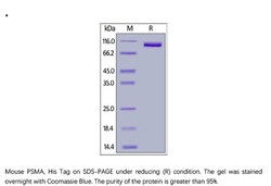 ACROBiosystems ACROBiosystems Mouse PSMA / FOLH1 Protein, His Tag, Quantity: