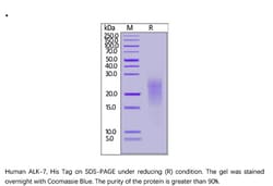 ACROBiosystems ACROBiosystems Human ALK-7 Protein, His Tag, Quantity: Each