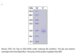 ACROBiosystems Mouse TSLP Protein, His Tag