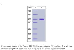 ACROBiosystems ACROBiosystems Cynomolgus Nectin-4 Protein, His Tag, Quantity: