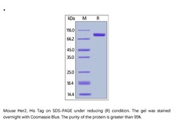 ACROBiosystems ACROBiosystems Mouse Her2 / ErbB2 Protein, His Tag, Quantity: