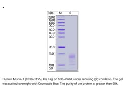 ACROBiosystems ACROBiosystems Human Mucin-1 / MUC-1 (1036-1155) Protein,