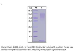 ACROBiosystems ACROBiosystems Human Mucin-1 / MUC-1 (890-1158) Protein,