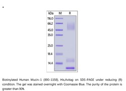 ACROBiosystems ACROBiosystems Biotinylated Human Mucin-1 (890-1158) Protein,