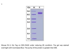 ACROBiosystems ACROBiosystems Mouse Flt-3 / Flk-2 Protein, His Tag, Quantity: