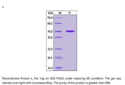 ACROBiosystems Inc ACROBiosystems Recombinant Protein L Protein, His Tag