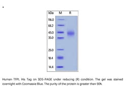 ACROBiosystems ACROBiosystems Human TFPI Protein, His Tag, Quantity: Each