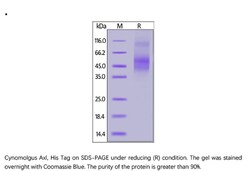 ACROBiosystems ACROBiosystems Cynomolgus Axl Protein, His Tag, Quantity: